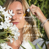 ridules atténuées après un mois d'usage