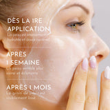 le grain de peau est visiblement lissé